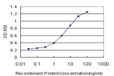 Anti-TIMM9 Mouse Monoclonal Antibody [clone: 1D6]