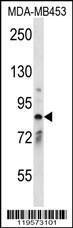 Anti-CNNM2 Rabbit Polyclonal Antibody (Biotin)