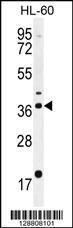 Anti-OR2W3 Rabbit Polyclonal Antibody (PE (Phycoerythrin))