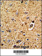 Anti-TPH1 Rabbit Polyclonal Antibody (Biotin)