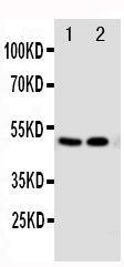 Anti-Vitamin D Receptor Rabbit Polyclonal Antibody