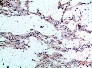 Immunohistochemical analysis of paraffin-embedded human lung using Anti-CSNK1A1 Antibody