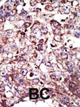 Anti-FNTA Rabbit Polyclonal Antibody