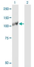 Anti-EPHB3 Mouse Monoclonal Antibody [clone: 3F12]