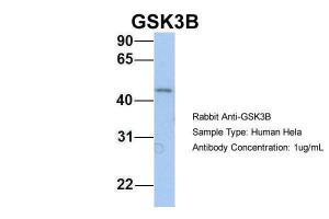 Anti-GSK3B Rabbit Polyclonal Antibody