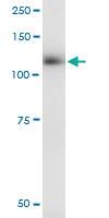 Anti-EPHB3 Mouse Monoclonal Antibody [clone: 3F12]