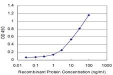 Anti-MED16 Mouse Monoclonal Antibody [clone: 2B7]