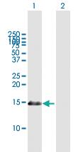 Anti-PDRG1 Mouse Polyclonal Antibody