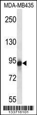 Anti-GRM6 Rabbit Polyclonal Antibody (PE (Phycoerythrin))