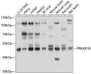 Anti-PRKAR1B Rabbit Polyclonal Antibody