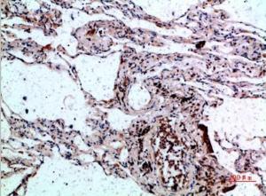 Immunohistochemical analysis of paraffin-embedded human lung using Anti-CSNK1A1 Antibody