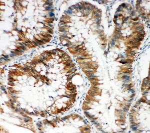 Anti-SQSTM1/p62 Rabbit Polyclonal Antibody