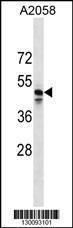 Anti-MRGPRF Rabbit Polyclonal Antibody (HRP (Horseradish Peroxidase))