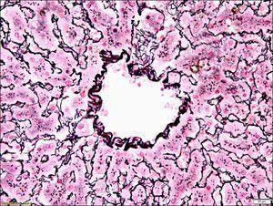 Reticulum TISSUE-TROL™ control slide