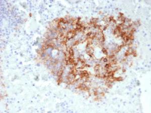 Immunohistochemical analysis of formalin-fixed, paraffin-embedded human lymph node tissue using Anti-CD35 Antibody [CR1/6380] at 2µg/ml