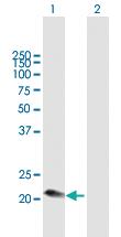 Anti-C1QC Mouse Polyclonal Antibody