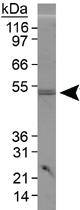 Anti-PLIN3 Rabbit Polyclonal Antibody