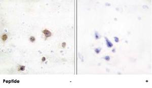 Anti-MAPK8IP2 Rabbit Polyclonal Antibody