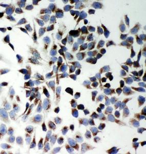 Anti-SQSTM1/p62 Rabbit Polyclonal Antibody