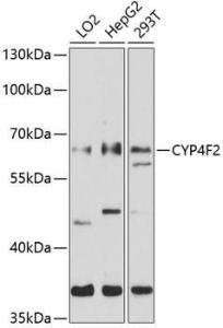 Western blot analysis of extracts of various cell lines, using Anti-CYP4F2 Antibody (A8532) at 1:1000 dilution