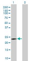 Anti-HPRT1 Rabbit Polyclonal Antibody