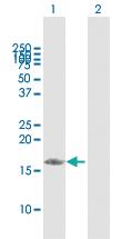 Anti-PDRG1 Rabbit Polyclonal Antibody