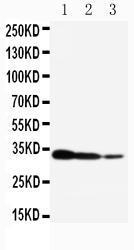 Anti-TORC2 Rabbit Polyclonal Antibody