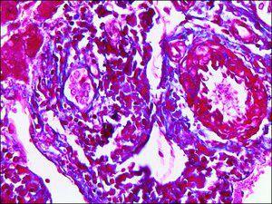 Trichrome stain AB solution