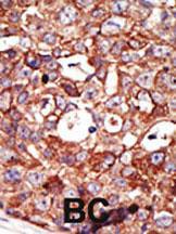 Anti-ZMPSTE24 Rabbit Polyclonal Antibody (Biotin)