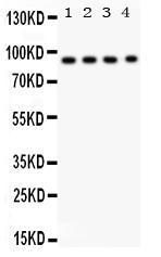 Anti-CD26 Antibody