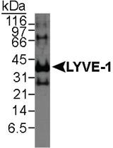 Anti-LYVE1 Rabbit Polyclonal Antibody