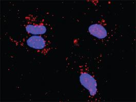 Anti-PDGFRA + PLCG1 Antibody Pair