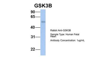 Anti-GSK3B Rabbit Polyclonal Antibody