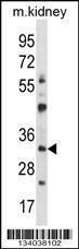 Anti-GTF2B Rabbit Polyclonal Antibody (APC (Allophycocyanin))