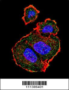 Anti-TSC2 Rabbit Polyclonal Antibody (HRP (Horseradish Peroxidase))