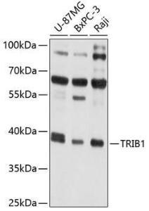 Western blot analysis of extracts of various cell lines, using Anti-TRIB1 Antibody (A8534) at 1:1,000 dilution