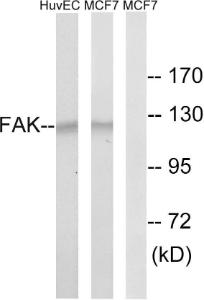 Anti-FAK Rabbit Polyclonal Antibody