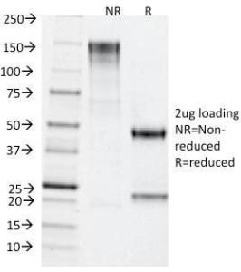 SDS-PAGE analysis of Anti-TDP2 Antibody [TDP2/1258] under non-reduced and reduced conditions; showing intact IgG and intact heavy and light chains, respectively. SDS-PAGE analysis confirms the integrity and purity of the Antibody