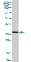 Anti-C1QC Rabbit Polyclonal Antibody