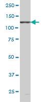 Anti-EPHB6 Mouse Monoclonal Antibody [clone: 5D8]