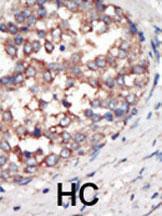 Anti-PI3KCG Rabbit Polyclonal Antibody (PE (Phycoerythrin))