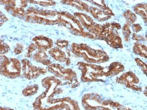 Anti-AMACR Rabbit Monoclonal Antibody [clone: 13H4]