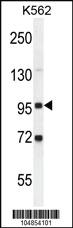 Anti-GPLD1 Rabbit Polyclonal Antibody