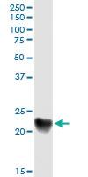 Anti-C1QC Rabbit Polyclonal Antibody