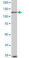 Anti-EPHB6 Mouse Monoclonal Antibody [clone: 5D8]