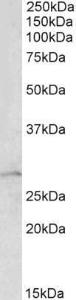 Antibody anti-RHOGDI 100 µg