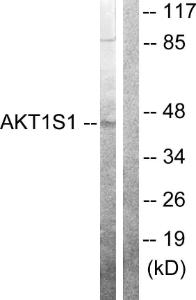 Western blot analysis of lysates from 293 cells using Anti-Akt1 S1 Antibody. The right hand lane represents a negative control, where the Antibody is blocked by the immunising peptide