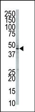 Anti-PIGK Rabbit Polyclonal Antibody