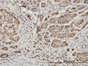 Anti-EPHB6 Mouse Monoclonal Antibody [clone: 5D8]