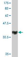 Anti-NOVA1 Mouse Monoclonal Antibody [clone: 5D9]